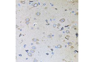 Immunohistochemistry of paraffin-embedded rat brain using MEMO1 antibody (ABIN5995855) at dilution of 1/100 (40x lens). (MEMO1 抗体)