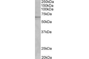 Western Blotting (WB) image for anti-Cytochrome P450, Family 1, Subfamily A, Polypeptide 2 (CYP1A2) (Internal Region) antibody (ABIN870662)