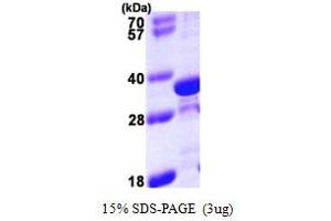 SDS-PAGE (SDS) image for Tropomyosin 4 (TPM4) (AA 1-248) protein (His tag) (ABIN667406) (Tropomyosin 4 Protein (TPM4) (AA 1-248) (His tag))