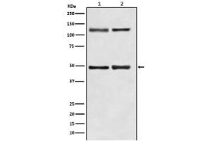All Lanes: NF-κB p105/p50 Antibody at 1/ 1000 dilution. (Recombinant NFkB 抗体)