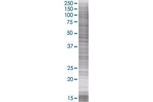 G0S2 transfected lysate. (G0S2 293T Cell Transient Overexpression Lysate(Denatured))