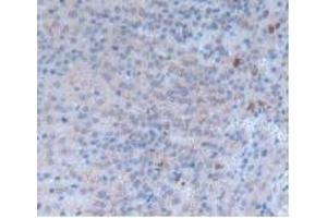 Detection of INHbA in Rat Adrenal Gland Tissue using Monoclonal Antibody to Inhibin Beta A (INHbA) (INHBA 抗体  (AA 314-424))