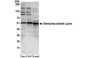 anti-Adenylosuccinate Lyase (ADSL) (AA 200-250) antibody