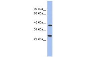 Image no. 1 for anti-Mitochondrial Translational Release Factor 1-Like (MTRF1L) (AA 35-84) antibody (ABIN6744041) (MTRF1L 抗体  (AA 35-84))