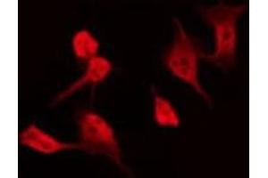 Immunofluorescence (fixed cells) (IF/ICC) image for anti-Apolipoprotein B mRNA Editing Enzyme, Catalytic Polypeptide-Like 4 (Putative) (APOBEC4) (C-Term) antibody (ABIN6258591)