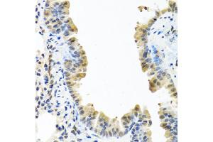 Immunohistochemistry of paraffin-embedded mouse lung using ARSF antibody (ABIN5974484) at dilution of 1/100 (40x lens). (ARSF 抗体)