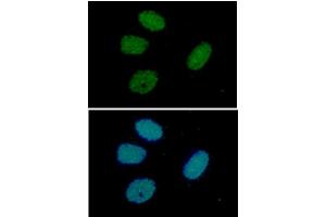 ICC/IF analysis of RuVBL in HeLa cells line, stained with DAPI (Blue) for nucleus staining and monoclonal anti-human RuVBL antibody (1:100) with goat anti-mouse IgG-Alexa fluor 488 conjugate (Green). (RUVBL1 抗体  (AA 1-456))