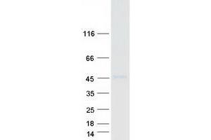 Validation with Western Blot (RORB Protein (Myc-DYKDDDDK Tag))