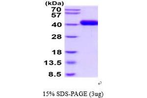 SDS-PAGE (SDS) image for Carnosine Dipeptidase 1 (Metallopeptidase M20 Family) (CNDP1) (AA 1-492) protein (His tag) (ABIN5854659) (CNDP1 Protein (AA 1-492) (His tag))