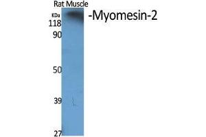 Western Blot (WB) analysis of specific cells using Myomesin-2 Polyclonal Antibody. (MYOM2 抗体  (Internal Region))