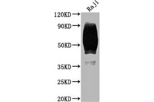 Western Blot Positive WB detected in: Raji whole cell lysate All lanes: CD80 antibody at 1:2000 Secondary Goat polyclonal to rabbit IgG at 1/50000 dilution Predicted band size: 34, 30, 19 kDa Observed band size: 60 kDa (Recombinant CD8 抗体)