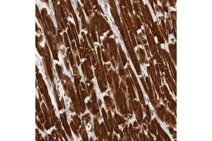 Immunohistochemical staining of human heart muscle with UBE3D polyclonal antibody  shows strong cytoplasmic positivity in myocytes at 1:20-1:50 dilution. (UBE3D 抗体)