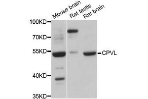 Western blot analysis of extracts of various cell lines, using CPVL antibody (ABIN6292365) at 1:3000 dilution. (CPVL 抗体)