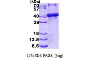 Image no. 1 for Biglycan (BGN) protein (His tag) (ABIN1098780) (Biglycan Protein (BGN) (His tag))