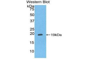 Western Blotting (WB) image for anti-Chemokine (C-X-C Motif) Ligand 16 (CXCL16) (AA 33-171) antibody (ABIN1858583) (CXCL16 抗体  (AA 33-171))