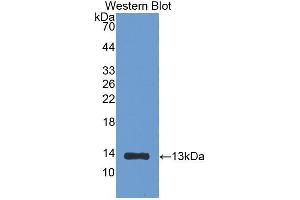 Western Blotting (WB) image for anti-beta-2-Microglobulin (B2M) (AA 21-119) antibody (ABIN1077856) (beta-2 Microglobulin 抗体  (AA 21-119))