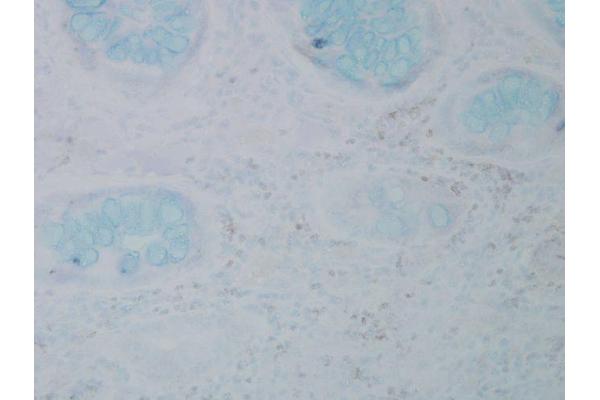 Nitrotyrosine 抗体  (HRP)