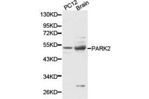 Western Blotting (WB) image for anti-Parkinson Protein 2, E3 Ubiquitin Protein Ligase (Parkin) (PARK2) antibody (ABIN1874032) (Parkin 抗体)