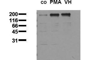 Western Blotting (WB) image for anti-Epidermal Growth Factor Receptor (EGFR) (pThr678) antibody (ABIN126757) (EGFR 抗体  (pThr678))