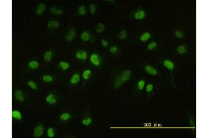 Immunofluorescence of monoclonal antibody to UBE2H on HeLa cell.