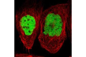 Immunofluorescent staining of human cell line A-431 shows localization to nucleoplasm.