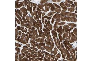 Immunohistochemical staining of human heart muscle with METTL16 polyclonal antibody  shows strong cytoplasmic positivity in myocytes at 1:200-1:500 dilution.