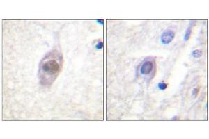 Immunohistochemistry analysis of paraffin-embedded human brain tissue, using APC antibody. (APC 抗体  (Internal Region))