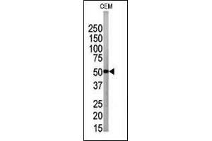 The anti-G4B Pab 1809a is used in Western blot to detect G4B in CEM tissue lysate (ATG4B 抗体  (N-Term))