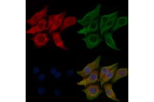 ABIN6257010 and ABIN6274258 staining Hela cells by IF/ICC. (KPB1/2 (Internal Region) 抗体)