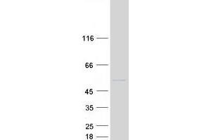 Western Blotting (WB) image for BRF2, Subunit of RNA Polymerase III Transcription Initiation Factor, BRF1-Like (BRF2) protein (Myc-DYKDDDDK Tag) (ABIN2715331)