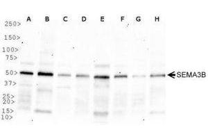 Western Blotting (WB) image for anti-Sema Domain, Immunoglobulin Domain (Ig), Short Basic Domain, Secreted, (Semaphorin) 3B (SEMA3B) (AA 100-200) antibody (ABIN1951824) (SEMA3B 抗体  (AA 100-200))