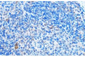 Immunohistochemistry of paraffin-embedded Mouse spleen using ADAR Polyclonal Antibody at dilution of 1:100 (40x lens). (ADAR 抗体)