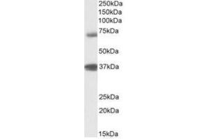 Antibody (1µg/ml) staining of Peripheral Blood Lymphocytes lysate (35µg protein in RIPA buffer). (TRIM29 抗体  (Internal Region))