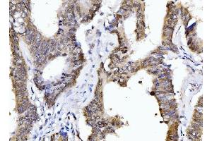 IHC analysis of Cyclophilin E/PPIE using anti-Cyclophilin E/PPIE antibody (ABIN7599242). (PPIE 抗体  (AA 1-301))
