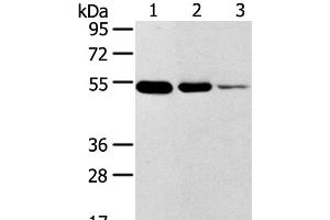 Western Blot analysis of Human thyroid and esophagus cancer, Human normal rectum tissue using TMPRSS11F Polyclonal Antibody at dilution of 1:500 (TMPRSS11F 抗体)