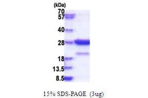 Syntaxin Binding Protein 6 (Amisyn) (STXBP6) (AA 1-210) protein (His tag)