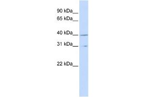 WB Suggested Anti-CCNH Antibody Titration:  0. (Cyclin H 抗体  (Middle Region))
