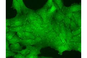 Immunocytochemistry/Immunofluorescence analysis using Mouse Anti-TrpC7 Monoclonal Antibody, Clone S64A-36 . (TRPC7 抗体  (AA 845-862) (HRP))