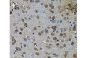 Immunohistochemistry of paraffin-embedded Rat brain using IL33 Polyclonal Antibody (IL-33 抗体)