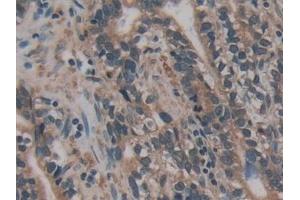 Immunohistochemistry (IHC) image for anti-Apoptosis-Associated tyrosine Kinase (AATK) (AA 1216-1374) antibody (ABIN7442786)