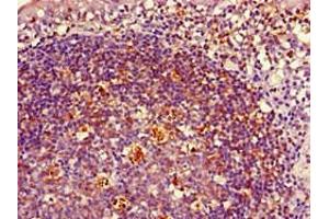 Immunohistochemistry of paraffin-embedded human tonsil tissue using ABIN7155618 at dilution of 1:100 (HLA-DRB1 抗体  (AA 31-266) (Biotin))