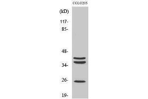 Western Blotting (WB) image for anti-Cathepsin B (CTSB) (Internal Region) antibody (ABIN3174199) (Cathepsin B 抗体  (Internal Region))