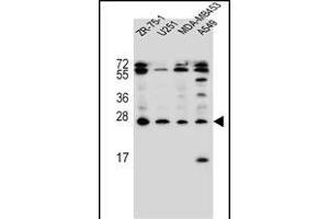 EDN1 Antibody (C-term) (ABIN655912 and ABIN2845311) western blot analysis in ZR-75-1,,MDA-M,A549 cell line lysates (35 μg/lane). (Endothelin 1 抗体  (C-Term))
