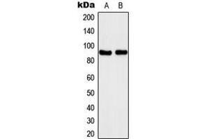 Western blot analysis of Kanadaptin expression in A431 (A), Jurkat (B) whole cell lysates. (NADAP 抗体  (Center))