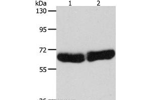 Western Blot analysis of Human fetal liver and brain tissue using CYP1B1 Polyclonal Antibody at dilution of 1:250 (CYP1B1 抗体)