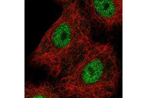 Immunofluorescent staining of A549 cells with HNF1B monoclonal antibody, clone CL0374  (Green) shows spotty nuclear (without nucleoli) staining. (HNF1B 抗体)