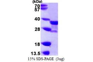 SDS-PAGE (SDS) image for N-Acetyltransferase 1 (Arylamine N-Acetyltransferase) (NAT1) (AA 1-290) protein (His tag) (ABIN667924) (NAT1 Protein (AA 1-290) (His tag))
