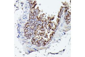 Immunohistochemistry (IHC) image for anti-Voltage-Dependent Anion Channel 3 (VDAC3) (AA 1-283) antibody (ABIN6150077)