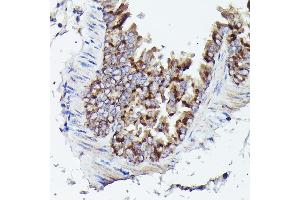 Immunohistochemistry of paraffin-embedded mouse lung using VD Rabbit pAb (ABIN6130775, ABIN6150077, ABIN6150078 and ABIN6214830) at dilution of 1:25 (40x lens). (VDAC3 抗体  (AA 1-283))