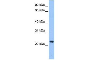Western Blot showing TRIM48 antibody used at a concentration of 1-2 ug/ml to detect its target protein. (TRIM48 抗体  (C-Term))